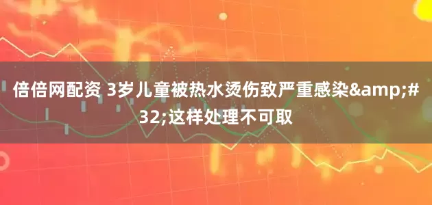 倍倍网配资 3岁儿童被热水烫伤致严重感染&#32;这样处理不可取
